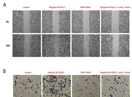 HSP90 inhibition by 17-AAG blocks cell motility (wound healing assay)(A) and cell invasion (in vitro invasion assay)(B) induced by TGF-β1 in Panc-1 cells