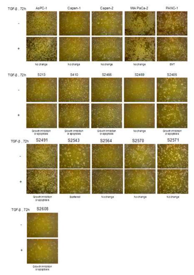 TGF-β에 의한 췌장암 세포주들의 표현형 변화 확인