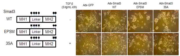 Smad3 인산화 부위 돌연변이를 췌장암 세포주에 형질 도입 후 표현형 관찰