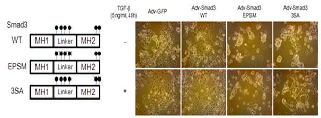 Smad3 인산화 부위 돌연변이를 췌장암 세포주에 형질 도입 후 표현형 관찰