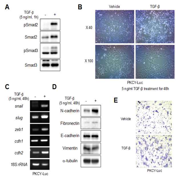 PKCY 췌장암 생쥐 유래 세포주 (PKCY)의 TGF-β에 대한 반응성 조사. (A) Smad2/3 단백질의 인산화 확인. (B) TGF-β에 의한 세포 모양 변화. (C, D) EMT 마커들의 mRNA, 단백질 발현양 확인. (E) TGF-β에 의한 세포 이동성 측정