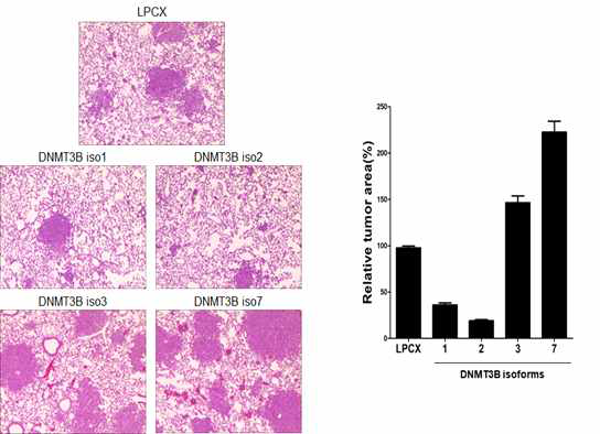 DNMT3B isoform 과발현 따른 폐전이 조직 분석과