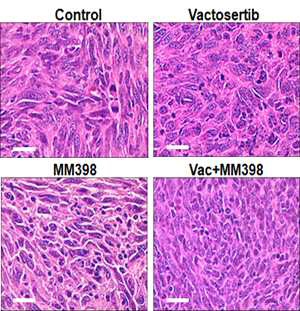 Vactosertib와 MM398의 단독 및 병용처리에 따른 췌장암 조직 분석