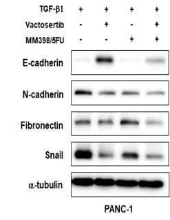 Vactosertib와 MM398/5-FU의 단독 및 병용처리에 따른 췌장암 세포의 EMT 마커의 변화