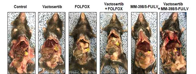 Vactosertib와 MM398/5-FU/LV 또는 FOLFOX의 단독 및 병용처리에 따른 암성장 억제 효과