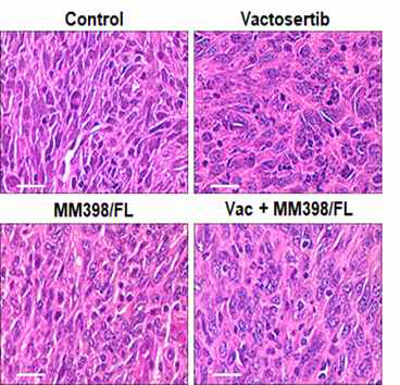 Vactosertib와 MM398/5-FU/LV의 단독 및 병용처리에 따른 췌장암 조직 분석