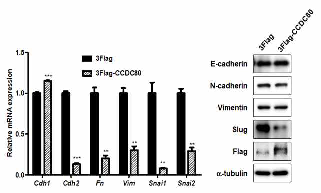 CCDC80 과발현에 따른 췌장암 세포의 EMT 마커의 변화