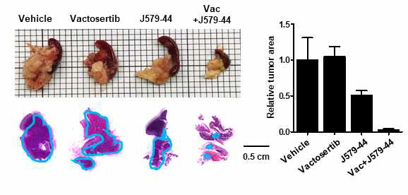 Vactosertib 및 J579-44 병용 처리 시 종양 성장 크기 비교