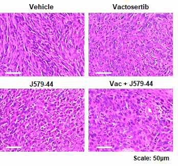 Vactosertib 및 J579-44 단독 및 병용 처리 시 종양 조직의 형태 변화