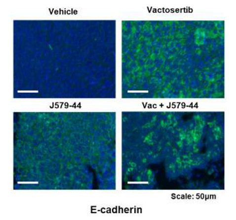 Vactosertib 및 J579-44 병용 처리 시 마우스 종양 조직에서의 E-cadherin 발현 (면역 형광 염색)