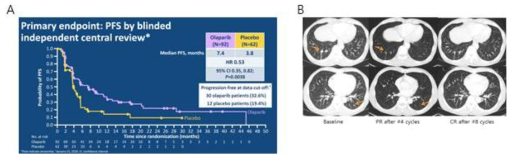 POLO 연구에서 PFS 향상 (A) 및 POLO study 임상환자 증례 (B)