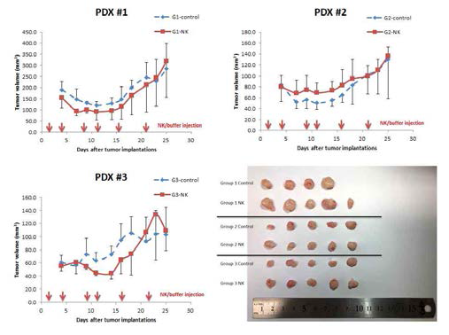 체외증식된 자연살해세포를 통한 PDX 에서의 치료효과 연구
