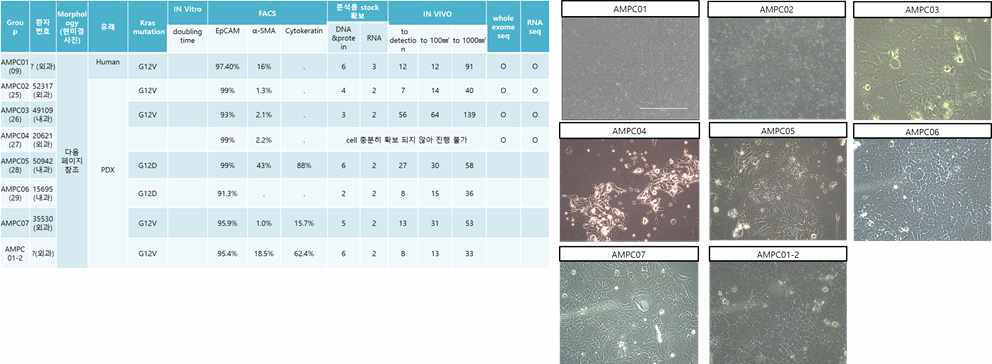 PDX 종양을 통해 구축된 췌장암 일차세포주