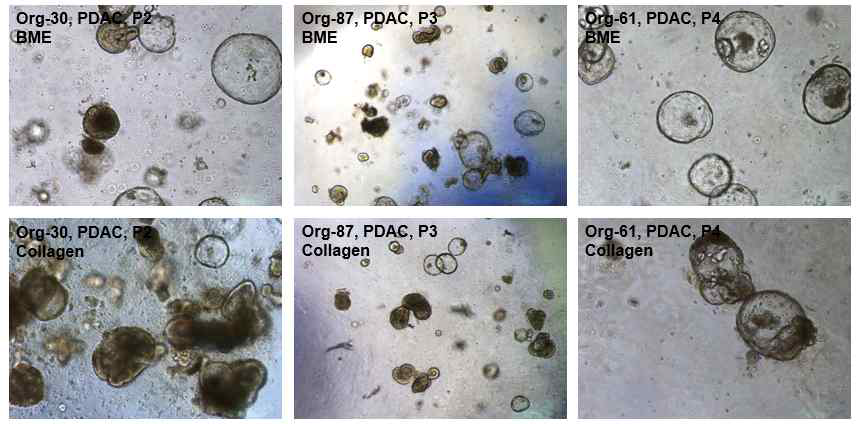 오가노이드 배양을 위한 세포외기질 개발