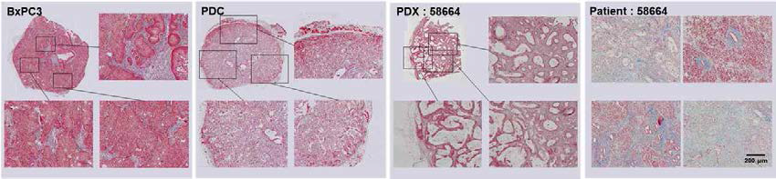 BxPC3, PDC, PDX, 환자 암 조직의 M.T 염색을 통한 콜라겐 분포 분석