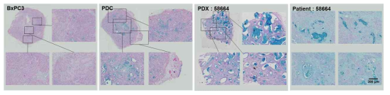 BxPC3, PDC, PDX, 환자 암 조직의 Alcian blue 염색을 통한 히알루론산 분포 분석