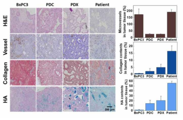 환자 조직, PDX와 세포주에서 혈관, 콜라겐 및 히알루론산 분포 확인