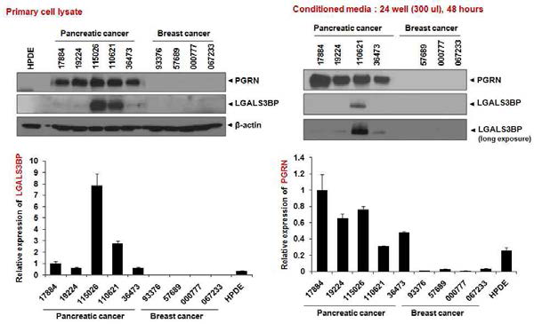췌장암 세포 및 conditioned media에서 단백질의 발현 확인