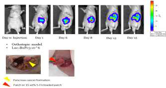췌장암 세포주를 이용한 췌장암 동소 (췌장) 모델 개발 및 약물함유 패치의 췌장 적용 기술 확립