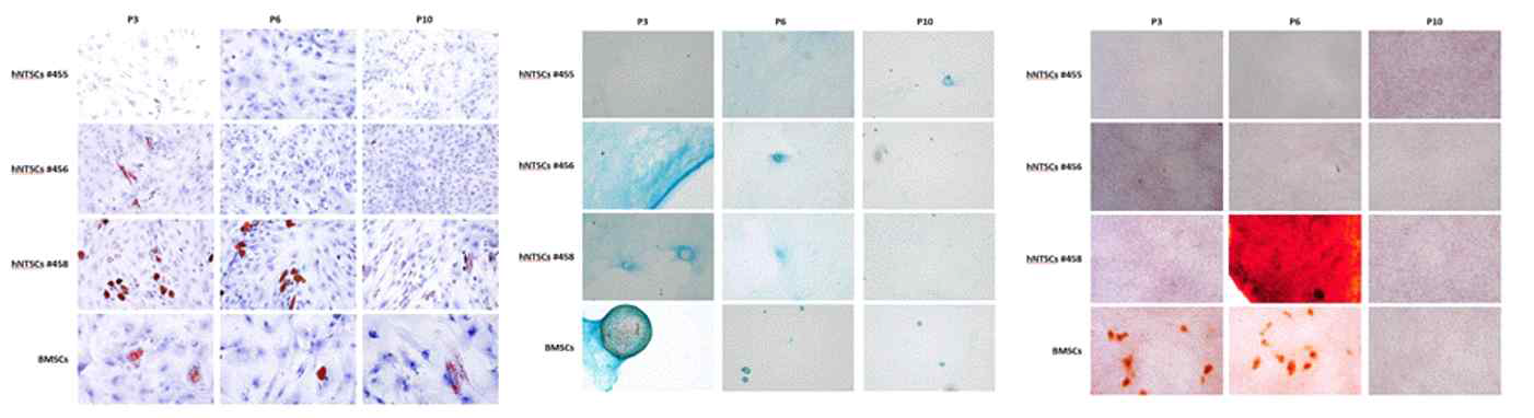 사람 코줄기세포에서 분화된 Oil red O(adipocytes), Alcian blue(chondrocytes), Alizarin red S(osteocytes)특이적 표식자 발현 관찰