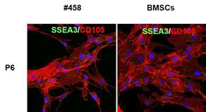 사람 코 유래 줄기세포와 골수 유래 줄기세포에서 면역염색을 통한 MUSE (SSEA-3, CD105) 발현 확인