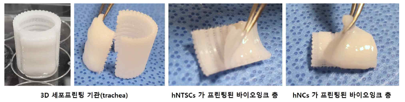 3D바이오프린팅 기관(trachea)의 품질분석 방법