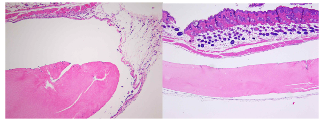 콜라젠 (좌)과 줄기세포를 포함하는 콜라젠 (우)을 투여한 군의 조직현미경 소견