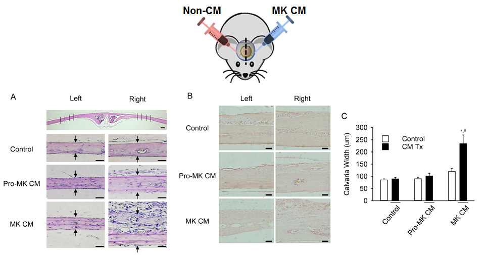 Calvaria bone formation assay. (위) 실험의 schematic figure. 두개뼈 단면의 H&E staining (A)과 ALP staining (B). C, 처치 전후 두개뼈 단면의 두께