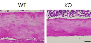 Vgf KO 마우스와 littermate WT 마우스 femur의 H&E staining. Vgf KO 마우스의 bone에서는 empty lacuna의 숫자가 늘어나 있음