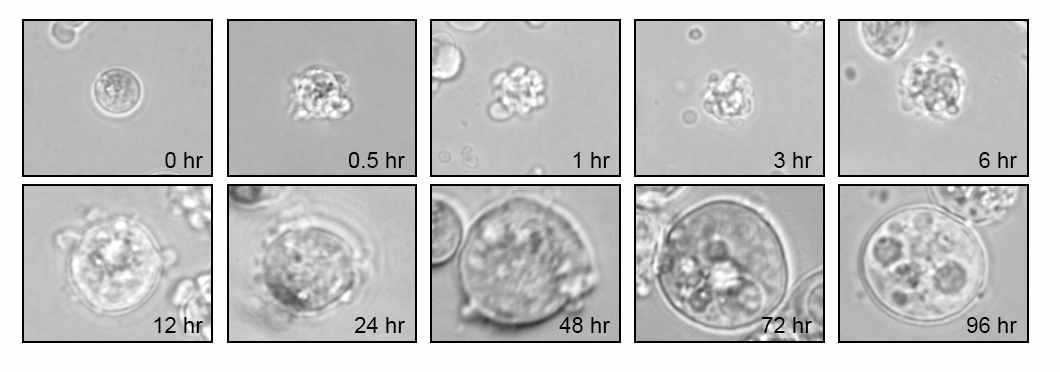 Morphology of PMA-treated human K562 leukemia cell line during megakaryocytic differentiation. K562 cells were treated with 20 nM PMA in serum-free RPMI 1640 media for 4 days. The cells were examined by phase contrast microscopy (×400)