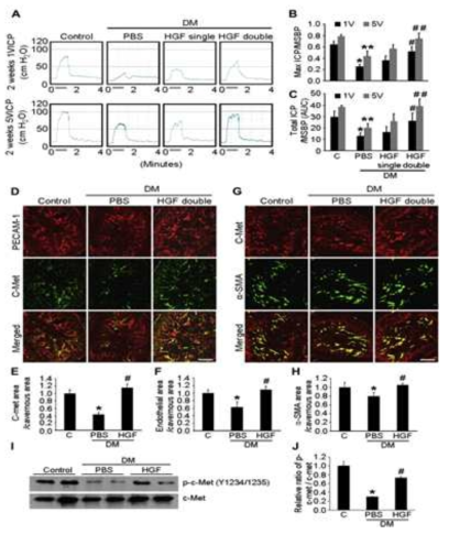 HGF protein transfer restores erectile function by increasing endothelial and smooth muscle content in diabetic mice