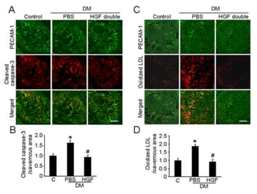 HGF protein transfer decreases apoptosis and cavernous oxidized LDL extravasation in cavernous endothelial cells of diabetic mice