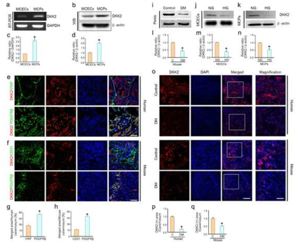 Decrease in DKK2 expression under diabetic conditions