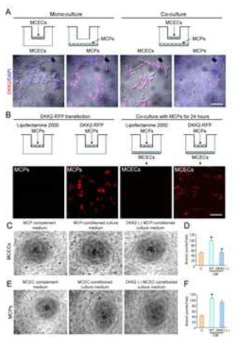 Pericyte-derived DKK2 migrates into endothelial cells and regulates angiogenesis