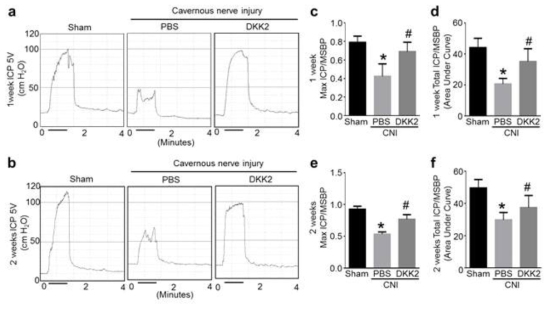 DKK2 restores intracavernous pressure (ICP) elicited by electrical stimulation of the cavernous nerve. (a, b) Representative ICP responses for the sham operation group or CNI mice stimulated at 1 or 2 weeks after intracavernous injections of PBS (20 μl) or DKK2 protein (days -3 and 0; 6 μg/20 μl). The stimulus interval is indicated by a solid bar. (c-f) Ratios of mean maximal ICP and total ICP (area under the curve) to mean systolic blood pressure (MSBP) were calculated for each group. Each bar depicts the mean (± SE) values from n = 6 animals per group. *P < 0.001 vs. sham operation group, #P < 0.05 vs. PBS-treated CNI group. CNI = cavernous nerve injury; DKK2 = dickkopf2