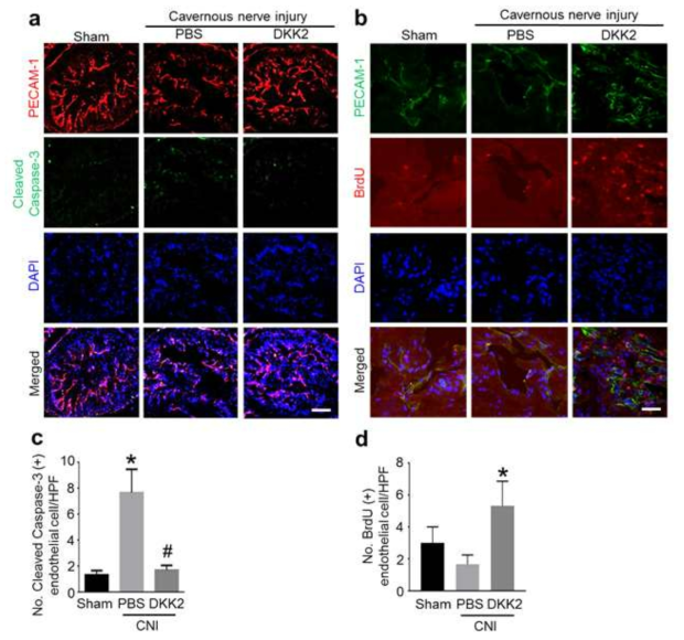 DKK2 decreases cavernous endothelial cell apoptosis and enhances endothelial cell proliferation. (a, b) PECAM-1 (red) and cleaved caspase-3 (green) or PECAM-1 (green) and BrdU (red) staining of cavernous tissue from sham operation group or CNI mice 1 week after receiving intracavernous injections of PBS (20 μl) or DKK2 protein (days -3 and 0; 6 μg/20 μl). Nuclei were labeled with DAPI (blue). Scale bar = 100 μm. (c) Number of apoptotic cells in endothelial cells per high-power field (screen magnification ´200). Each bar depicts the mean (± SE) values from n = 6 animals per group. *P < 0.001 vs. sham operation group, #P < 0.001 vs. PBS group. (d) Number of BrdU-immunopositive endothelial cells per high-power field (screen magnification ´400). Each bar depicts the mean (± SE) values from n = 4 animals per group. *P < 0.01 vs. PBS-treated CNI group. CNI = cavernous nerve injury; DKK2 = dickkopf2