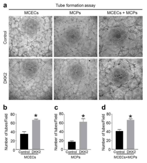 DKK2 enhances tube formation. (a) Tube formation assay in primary cultured mouse cavernous endothelial cells (MCEC) and pericytes (MCP) mono-culture system or in MCEC-MCP co-culture system, which were treated with PBS or DKK2 protein (300 ng/ml). (b-d) Number of tubes per high-power field. Each bar depicts the mean (± SE) values from n = 4 independent experiments. *P < 0.001 vs. control group. DKK2 = dickkopf2