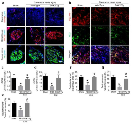 DKK2-Tg mice are resistant to CNI-induced neuropathy and angiopathy. (a) nNOS (red) and neurofilament (NF, green) staining of penis tissue from wild-type (WT) mice receiving sham operation, WT mice receiving CNI, or DKK2-Tg mice receiving CNI. Nuclei were labeled with DAPI (blue). Scale bar = 100 μm. (b) PECAM-1 (red) and NG2 (green) staining of cavernous tissue from each group. (c-g) Quantitative analysis of nNOS- and nerofilament-immunopositive area in dorsal nerve bundle, and cavernous endothelial and pericyte content was performed by an image analyzer. Each bar depicts the mean (± SE) values from n = 4 animals per group. *P < 0.001 vs. WT + sham operation group, #P < 0.001 vs. WT + CNI group. CNI = cavernous nerve injury; DKK2-Tg = dickkopf2-transgenic mice