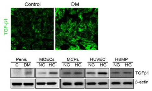 TGFb1 expression in diabetic condition. (정상 및 당뇨조건의 음경조직. 음경 혈관내피세포, 음경 혈관 주위세포, 및 인간 혈관내피세포에서 당뇨 조건하에서 TGFb1의 발현 증가함. 인간 혈관 주위세포에서 TGFb1의 발현차이는 없음)