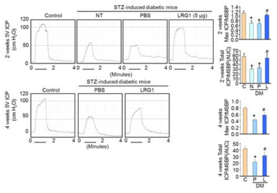 LRG1 protein transfer restores erectile function in diabetic mice. (LRG1 단백질의 음경 내 국소 투여가 당뇨성 발기부전모델에서 발기력을 회복시킴)