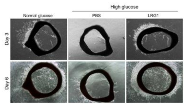 LRG1 promotes microvessel sprouts from mouse aortic ring. (대동맥절편을 이용한 실험에서 LRG1 단백질이 고 글루코스 조건에 의해 저해된 내피세포 sprouting을 정상 글루코스 조건 수준으로 회복시킴)