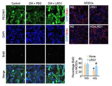 LRG1 enhances cavernous endothelial cell proliferation in diabetic mice in vivo and primary cultured mouse cavernous endothelial cells (MCECs) in vitro. (당뇨조건의 음경조직 및 음경 혈관내피세포에서 LRG1 단백질이 혈관내피세포의 증식을 촉진함)