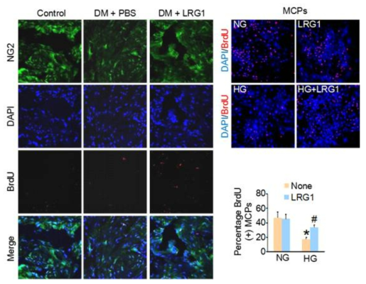 LRG1 enhances cavernous pericyte proliferation. (당뇨조건의 음경조직 및 음경 혈관주위세포에서 LRG1 단백질이 혈관주위세포의 증식을 촉진함)