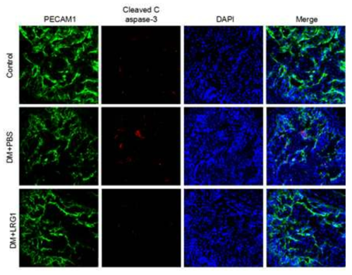 LRG1 decreases cavernous endothelial apoptosis. (당뇨조건의 음경조직 및 음경 혈관내피세포에서 LRG1 단백질이 혈관내피세포의 apoptosis을 억제함)