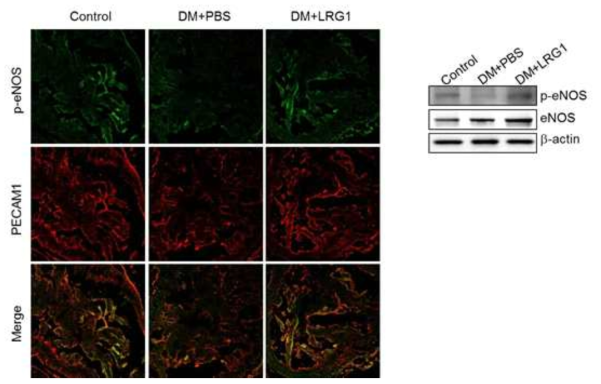 LRG1 transfer induces eNOS phosphorylation in diabetic mice. (LRG1 단백질의 음경 내 국소 투여가 당뇨성 발기부전모델의 음경에서 eNOS 인산화를 촉진함)