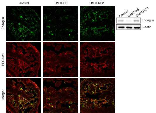 LRG1 transfer up-regulates endoglin expression in cavernous endothelial cells of diabetic mice. (LRG1 단백질의 음경 내 국소 투여가 당뇨성 발기부전모델의 음경 혈관내피세포에서 LRG1의 작용에 중요한 역할을 하는 endoglin의 발현을 증가시킴)