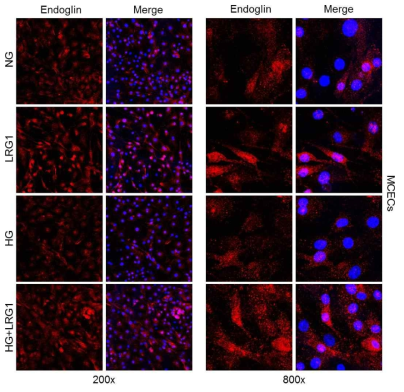 LRG1 transfer up-regulates endoglin expression in mouse cavernous endothelial cells (MCECs) exposed to high-glucose condition. (음경 혈관내피세포에서 LRG1 단백질이 고 글로코스 조건에 의해 감소된 endoglin 발현을 정상 수준으로 회복함)