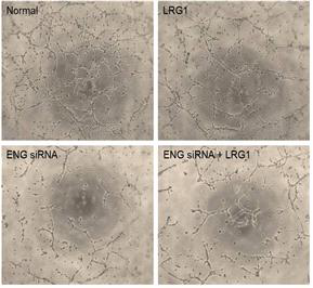 Inhibition of endoglin with siRNA blocks LRG1-medicated tube formation in mouse cavernous endothelial cells. (음경 혈관내피세포에서 endoglin siRNA를 전처리하였을 때 LRG1 단백질에 의한 튜브형성 촉진이 나타나지 않음. 이는 LRG1의 혈관신생 작용에 있어서 endoglin이 중요한 역할을 함을 의미함)