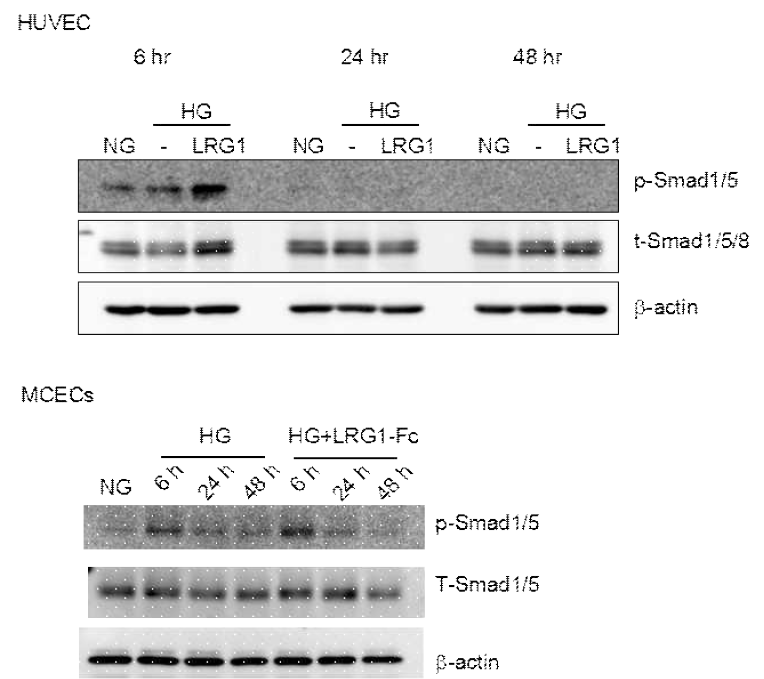 LRG1 transfer induces phosphorylation of Smad1/5 in huvec and mcecs. (LRG1 단백질이 음경혈관내피세포 및 인간제대정맥에서 혈관신생과 관련된 Smad1/5 인산화를 촉진함)