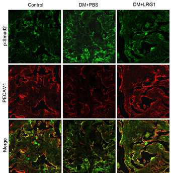 LRG1 transfer decreases phosphorylation of Smad2 in diabetic mice. (LRG1 단백질의 음경 내 국소 투여가 당뇨성 발기부전모델의 음경에서 조직섬유화와 관련된 Smad2 인산화를 억제함)